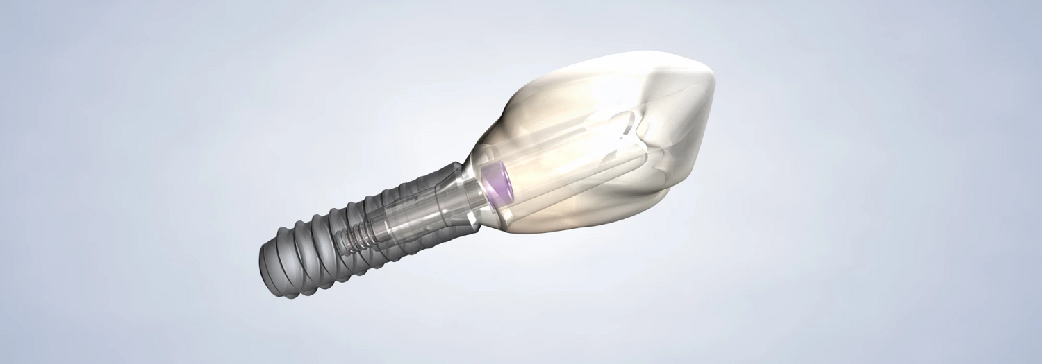 Dental Implants procedure arizona oral and maxillofacial surgery